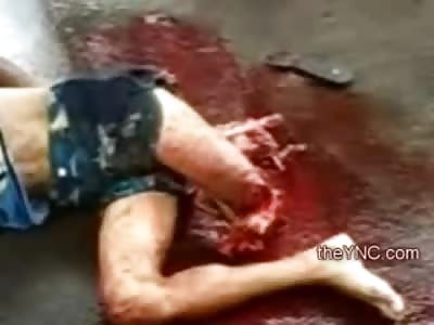 WOW: Man with Dangling Mangled Leg Squirms in his Own Blood in the Rainy Street (3 Videos from Different Cell Phones)