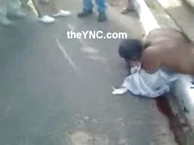 FULL Video of Man in Shock with his Arm Ripped off the Shoulder