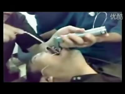 Laughing Doctors find the Strangest Thing inside a Mans Throat