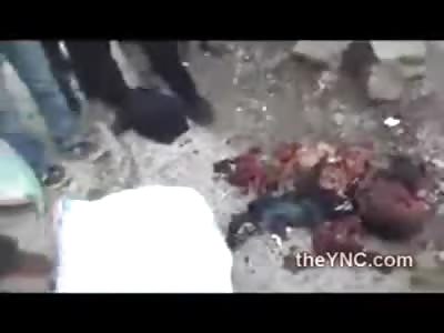Bomb Aftermath is Always as Gruesome as it Gets...Barely Recognizable Bodies Everywhere