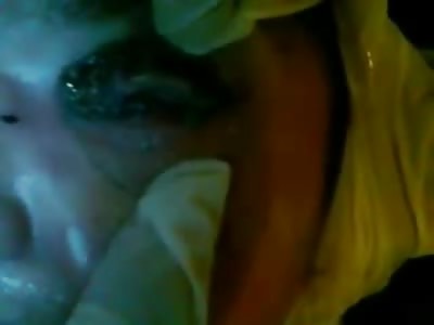 Creepy video of Female with an Infected Eye