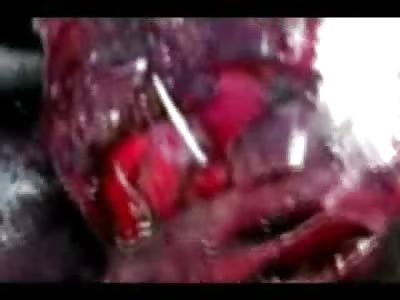 Hollow Man..Disturbing Video shows Cameraman stick Phone in Dying Mans Face, other Man alive with Stomach hanging Out