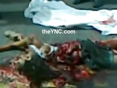 Wow...Woman in a Twisted Mess with Intestines Exposed is left on the Street...