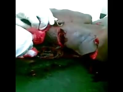 SHOCK VIDEO: Half Naked Woman Slashed Apart by Crazy Ex-Boyfriend, Her Hand is Gone
