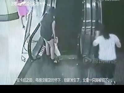 Poor girl loses her foot in Escalator accident...then Tries to Walk On It.....