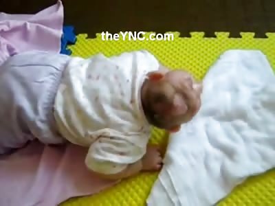 Very Sad Video of Poor Child with Horrible Affliction Microephaly
