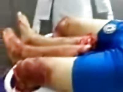 The Shocking Full Uncut Video of Soccer Referee that was Hacked up in Little Pieces by Players Family
