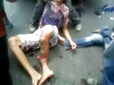 Short but Brutal..Boy with Severe Leg Injury Squirms on the Street