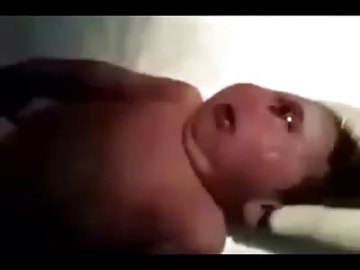 Sad Video of New Baby Born with No Nose and Cyclops