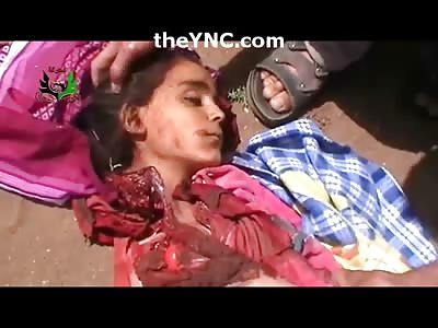 Sad Video Shows Girl Ripped Completely in Half From Bomb