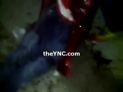 Man Brutally Attacked with a Machete Bleeding from Well, Everywhere