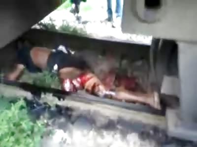 Put the Leg in the Bag...Man Killed by Train
