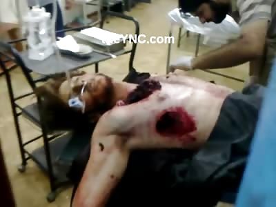 Man with Huge Hole in his Chest, Part of Lung Hanging out... Still Alive