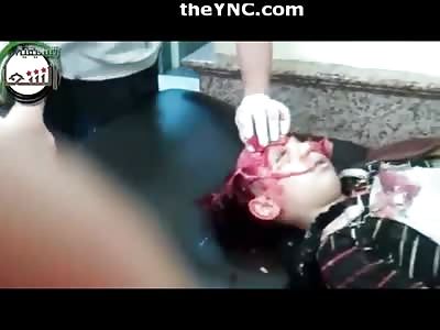 Very Shocking Video of Boy with Head Exploded like a Mushroom..Video is Graphic