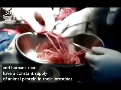 Disgusting: 10 Pounds of Meat Worms pulled out of Bodybuilders Colon