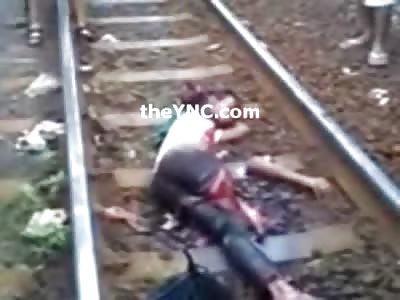 Man Hit by Train, Body Severed but Still Talking