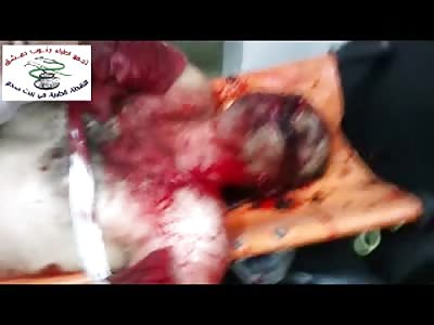 Sisturbing Video of Man Severely Wounded and Bloody as all Hell, Clings to Life on the Operating Table