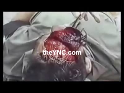 Mans Horrible Head Injury after Accident....Doctor Looks like he's Having Fun