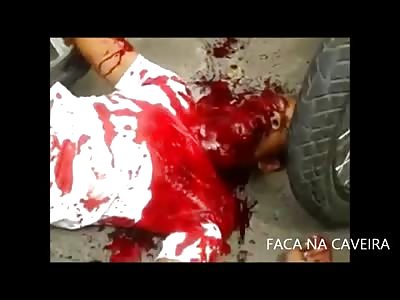 Absolutely Gruesome Footage Up Close of Boy Vomiting Blood all over Himself,. Covering his Face as he Dies in the Street (Newer Footage)