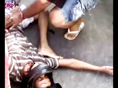The Eyes of Agony .... Motorcyclist Twisted up after Accident