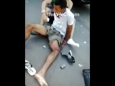 Boy with Broken Femur trying to Move in Agony as it Flops Around 