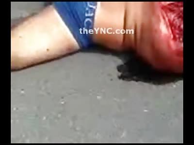 Dead Skin Mask!! more Gruesome Footage of the Man who left his Face on the Highway
