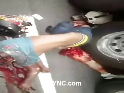 Man Crushed Under Truck Next to the Passengers Leg