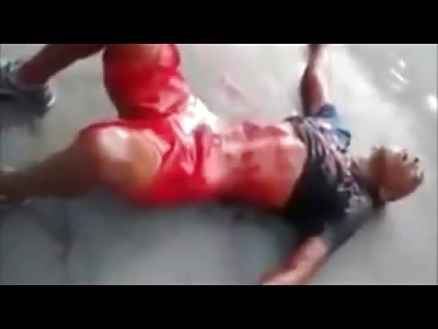 Motorcycle Thief Dying in Total Agony after Being Shot