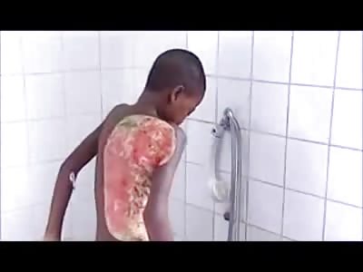 DISTURBING: Little African Kid shows off Sickening Flesh Eating Disease 