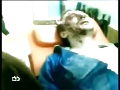 Man with a Knife Stuck in His Head in Total Pain