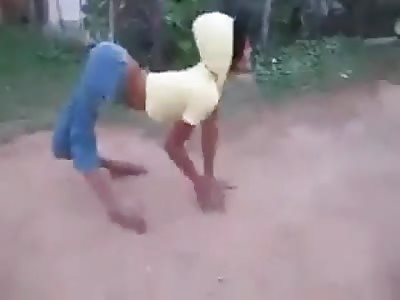 Bizarre Deformed Woman Doing a Super Twerk Dance