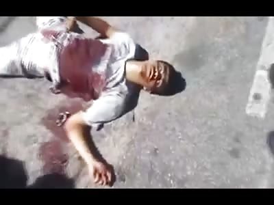 Thief Agonizing after being Shot by Police..Camera gets a Good Shot of his Face