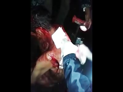 Naked Man Bleeding Badly after Being Used as a Pin Cushion by a Knife Attacker 
