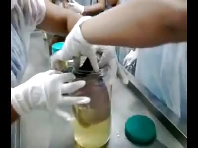 Very Bizarre Video shows Medical Students Examining a Headless New Born Baby (Video is Graphic) 