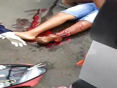 Mans Leg is Ripped up at the Ankle Following Crazy Accident