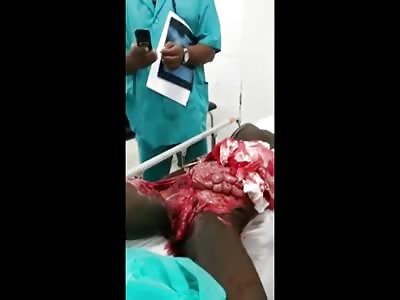 Motorcycle Accident Victim in the Emergency Room with his Guts Out on his Lap