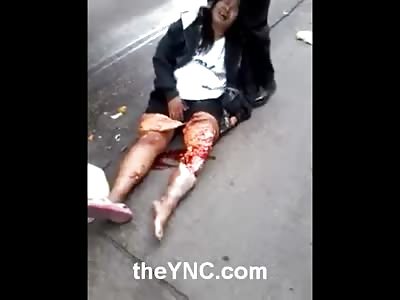 Woman in Total Agony with her Leg Ripped to Shred Screaming and Crying