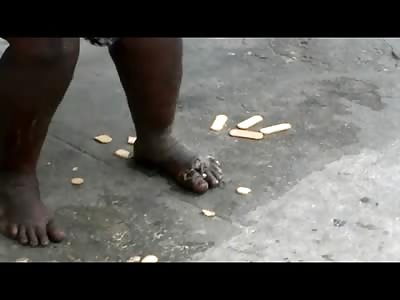 Disgusting Homeless Woman With Maggots Festering in her Feet Doesn't Give One fuck