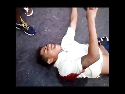 This Man Can No Longer Move His Legs..He was Shot by Police and Later Died 