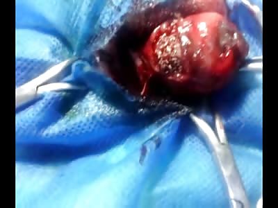 Sad Video Shows Dog getting its Eye Removed Filled with Maggots