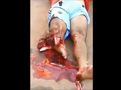 Man with Horribly Mutilated Leg lies in Shock Flopping Around on the Concrete 