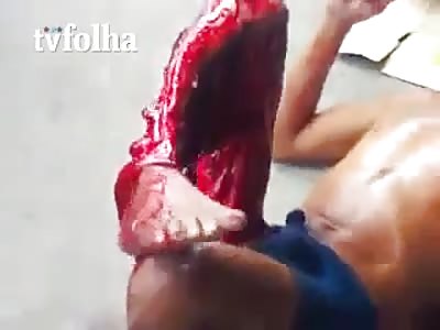 Prisoner  Tortured by  Peeling all the Skin of His Leg in Brazil