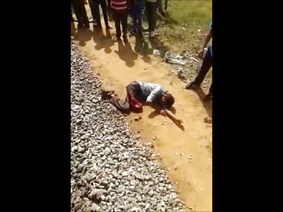 Man Tossed Aside by Train Missing his Leg 