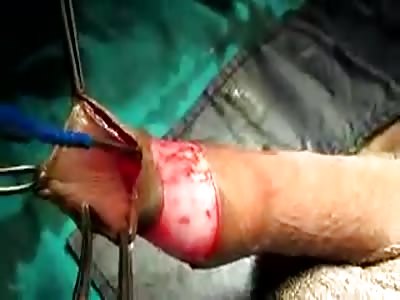 Penis Mutilation Porn - Search Results for: Penis Page 1