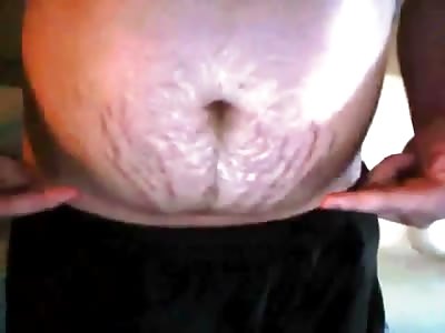 Fucking Weirdo Shows His Stretch Marks and...