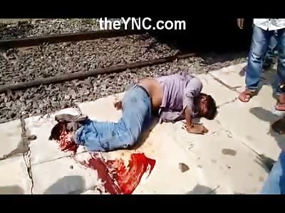 Man in Total Agony Squirming after his Foot is Ripped off by a Train