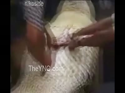 father recognized his daughter's body (alligator opening)