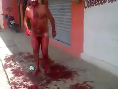 Man cuts off his own penis after being betrayed by his wife - Brazil