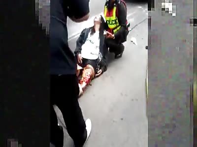 Woman on Cycle Gets Hit by Truck and Skins Her Knee