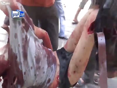 Brutal Aftermath Of Random Shelling by FSA Rebels